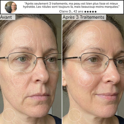 Système de Micro-Infusion