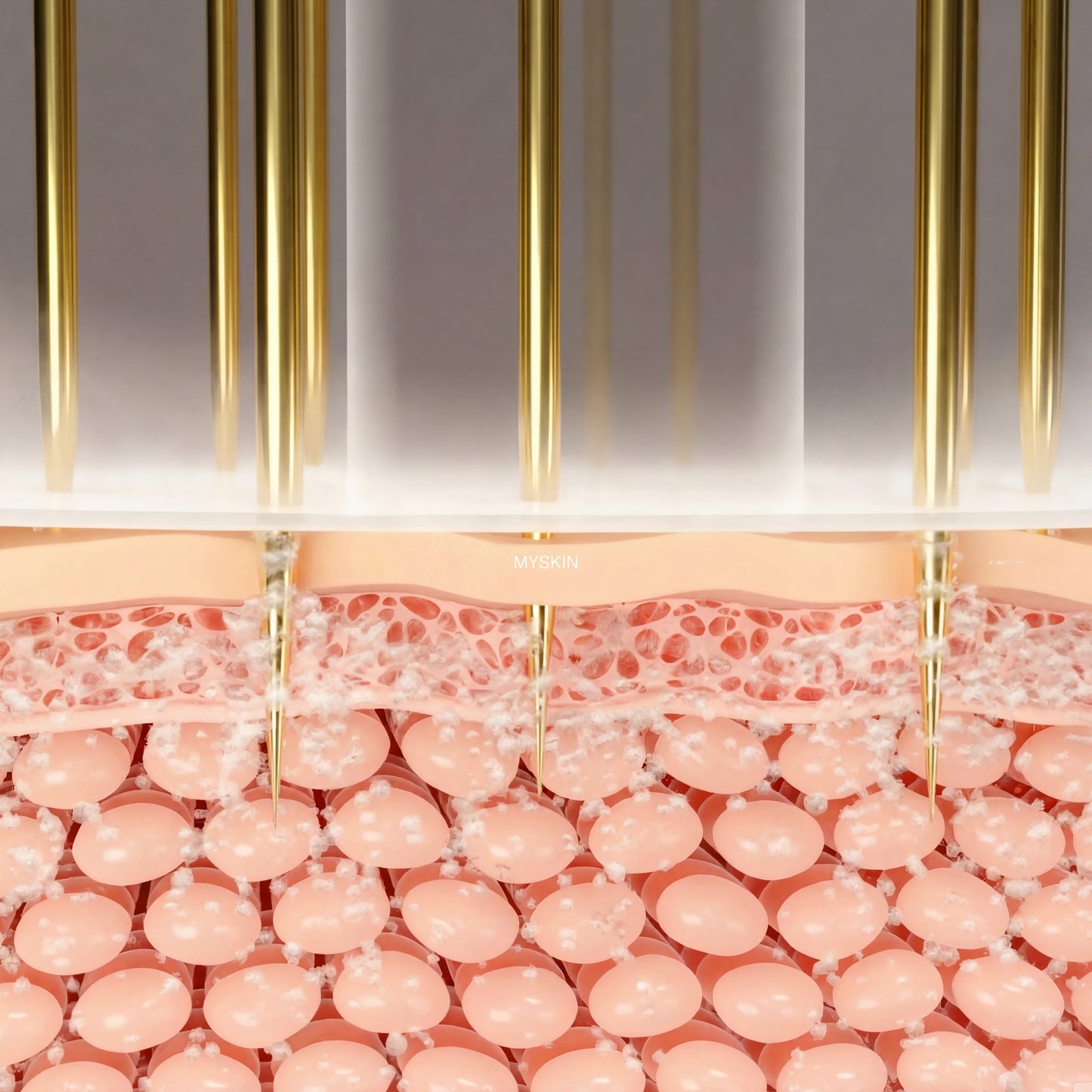 Système de Micro-Infusion